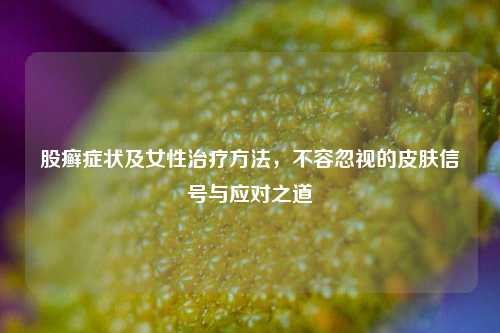股癣症状及女性治疗方法,不容忽视的皮肤信号与应对之道